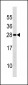 DENR Antibody (Center)
